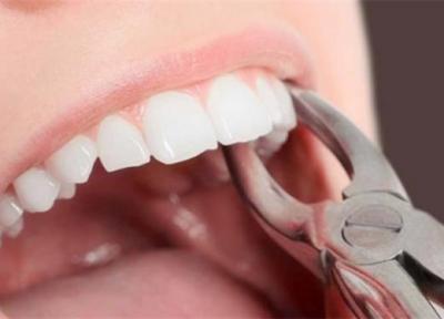 مراقبت های غذایی پس از کشیدن دندان عقل