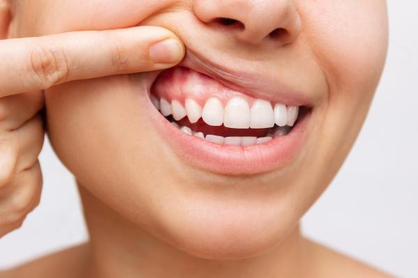 توصیه های بهداشتی برای مراقبت از دندان ها