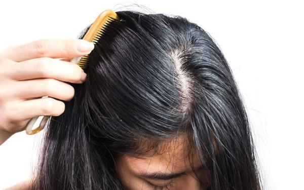 5 روش برای رهایی از چربی مو